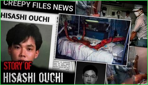 Hisashi Ouchi: The Story Of A Life Cut Short